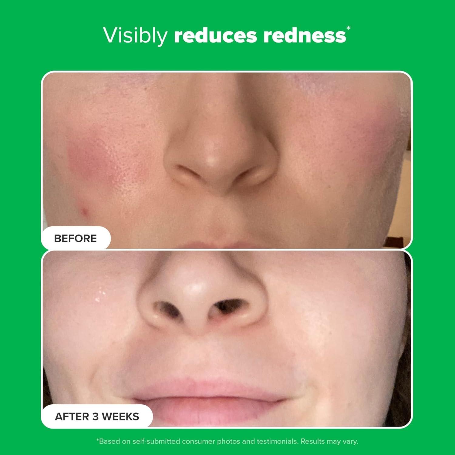 image:imagePaulas Choice BOOST 10 Azelaic Acid Booster Cream Gel Face Serum with Salicylic Acid OilFree Skin Brightening Serum for Face FragranceFree1 Fl Oz Pack of 1
