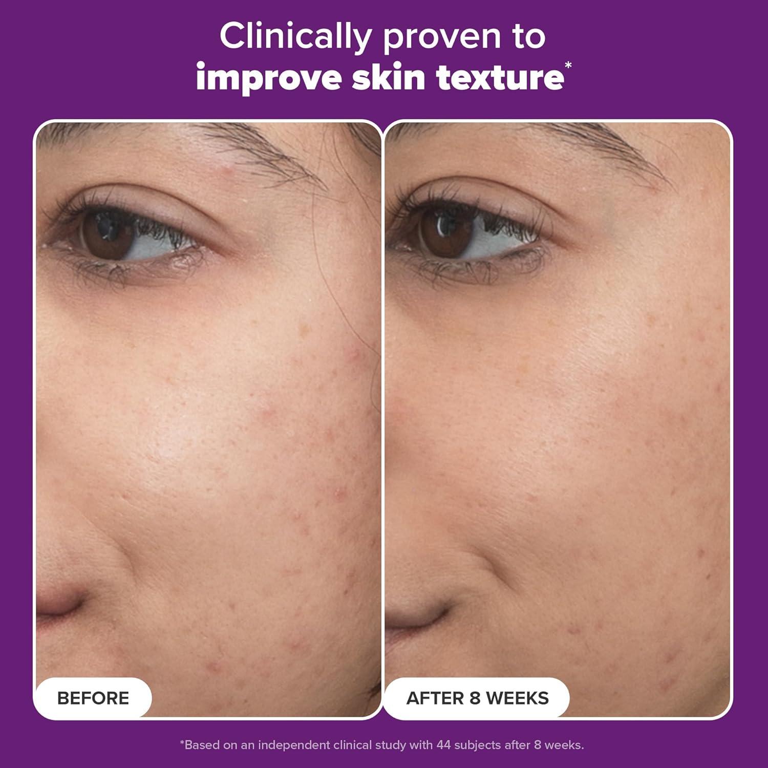 image:imagePaulas Choice Pro Retinaldehyde DualRetinoid Face Serum Advanced Treatment High Potency AntiAging Serum for Face BreakoutProne Skin Radiance amp Rough Bumpy Texture FragranceFreeFull Size 1 Fl Oz