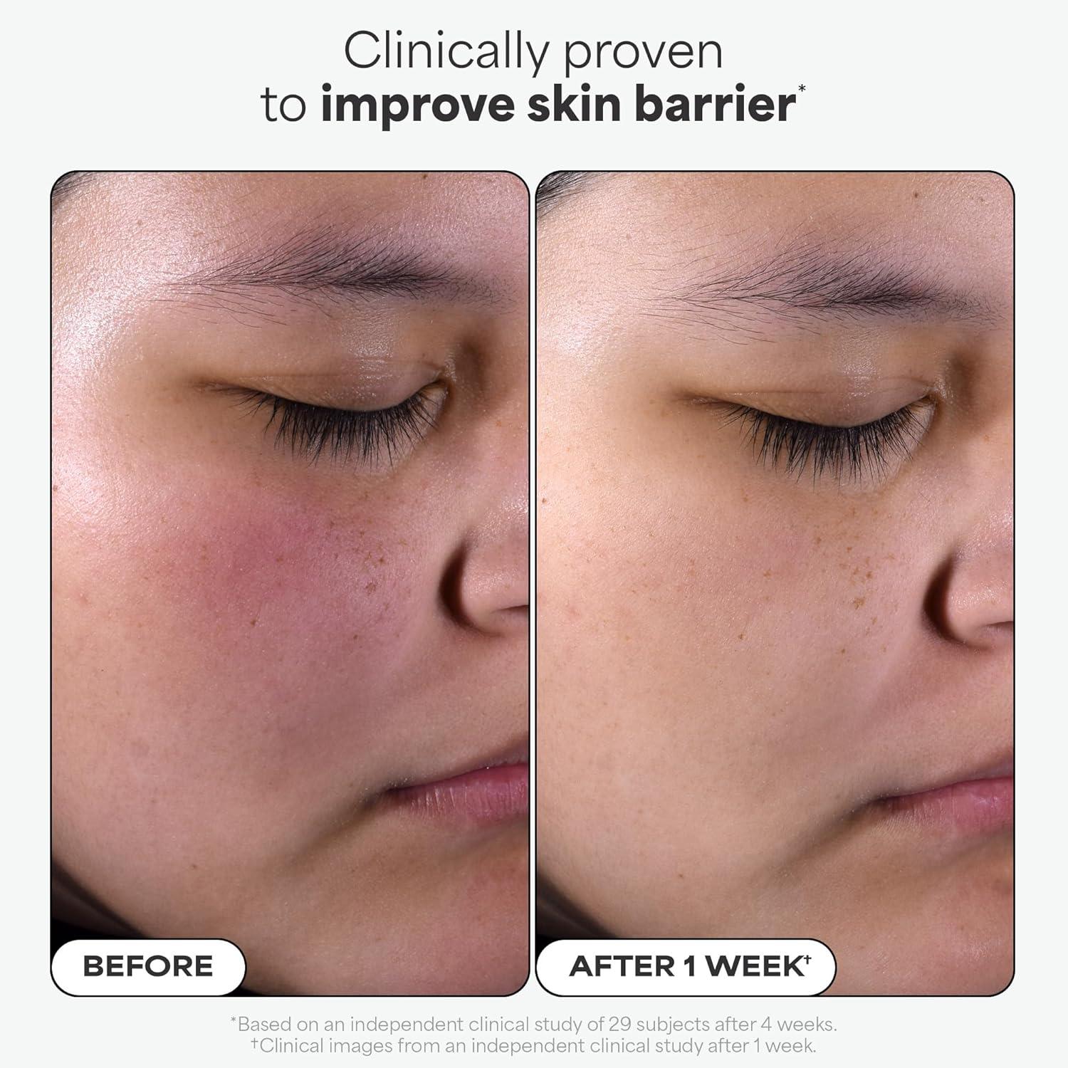 image:imagePaulas Choice SKIN PERFECTING 2 BHA Liquid Exfoliant with Salicylic Acid Facial Polish for Enlarged Pores Wrinkles amp Fine Lines Suitable for BlackheadProne Skin FragranceFreeFull Travel Size Duo 5 Fl Oz