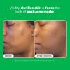 Paula’s Choice BOOST 10% Azelaic Acid Booster Cream Gel Face Serum with Salicylic Acid, Oil-Free Skin Brightening Serum for Face, Fragrance-Free(1 Fl Oz (Pack of 1))
