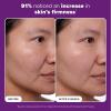 Paula’s Choice CLINICAL 1% Retinol Face Treatment with Peptides, Vitamin C & Licorice Extract, Anti-Aging Skin Care Serum, Fine Lines & Wrinkles, Fragrance Free(1 Ounce (Pack of 1))