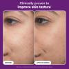 Paula’s Choice Pro Retinaldehyde Dual-Retinoid Face Serum Advanced Treatment, High Potency Anti-Aging Serum for Face, Breakout-Prone Skin, Radiance & Rough, Bumpy Texture, Fragrance-Free(Travel Size – 0.17 Fl Oz)