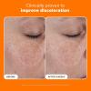 Paula’s Choice 25% Vitamin C Serum with Glutathione & Antioxidants, Face Serum Improves Discoloration, Uneven Tone & Firms, All Skin Types, Fragrance-Free, 1oz