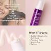 Paula’s Choice CLINICAL Discoloration Repair Face Serum with Tranexamic Acid, Facial Serum for Stubborn Dark Spots, Post-Acne Marks & Sun Damage, Fragrance-Free, 1 Fl Oz